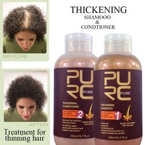 효과 모발 샴푸 및 컨디셔너 모발 성장 및 탈모용 조기 숱이 예방 남녀 용 모발|Hair Loss Products|, 1개, 단일