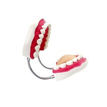 구강 지도 간호 치과 병원 치위생학과 치위생사 중증도 치주 tbi TBI 모델 모형 질환 교육 환자 상담 교육 용 칫솔질 잇솔질 교육 덴티폼, 투명한 치추