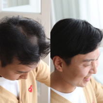 [M2002] 인모 100% 불파트 가르마형 프리스타일형 투페 남자가발, 좌가르마(투페), 15cmx18cm