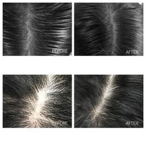 비듬 탈모 방지 시원한 두피샴푸 Polygonum Multiflorum 모이스춰 라이징 샴푸 리프레싱 오일 컨트롤 안티, 한개옵션0