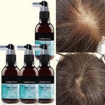 바로티나 탈모영양제 뉴헤어토닉 임상완료 탈모영양제 모근강화 M자 정수리 남성 여성 두피 탈모에 좋은 영양제 토닉, 4개