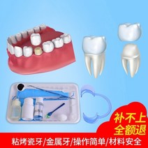 WEIYANG 치아접착제 구타 페르카 자가사용 에나멜 특수 접착제 틀니접착제 의치접착제, 01 일반형(오픈클립+소독액)