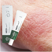 건선약 손 손가락 발 두피 건선 연고 크림 가려움 20ml, 1개