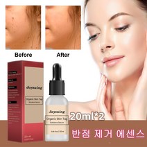 20ml*2 얼굴 반점 제거 에센스 검버섯 기미 주근깨 반점제거에센스정품 브라이트닝 반점 제거 반점 제거 에센스 기미앰플, 20ml(박스), 20ml, 2개