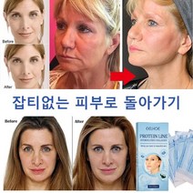jioy 실리프팅 콜라겐 리프팅실 페이스 리프트 60PCS*1P/2P/3P, 실리프팅(60pc(5*12pcs)*콜라켄 실리프팅)*1