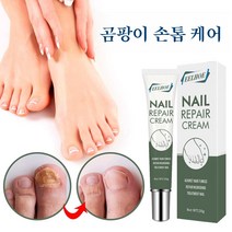 EELHOE 1+1 발톱무좀치료 손 발톱 무좀 연고 발톱 무좀 관리, 2개, 20g
