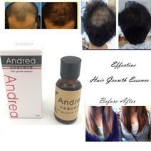 Andrea-모발 성장 생강 오일 천연 식물 에센스 빠르게 성장하는 수염 속눈썹 헤어 토닉 샴푸 탈모 케어 세트, [01] Nourishing