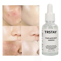 20% 글리콜 산 오일 리퀴드 안티 링클 페이스 크림 화이트닝 스킨 케어 에이징 세럼 제품, 01 30ml