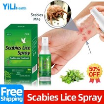 사면발이 옴 스프레이 치료 머릿니 가려움증 방지 액체 진드기 건선 제거 스킨 케어, 제비꽃