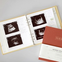 초음파앨범 꾸미기 사진보관 아기성장 포토북 태아앨범 태교 일기장 임신 다이어리, 옐로우