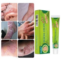 피부 가려움증 연고 습진 모낭염 두피 건선연고 지루성피부염 치료, 20ml, 5개