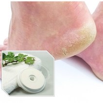 발바닥 발 각화증 발뒤꿈치 무좀 손가락 복숭아뼈 새끼 엄지 발가락 굳은살 제거 남자발관리