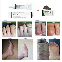 특허물질 도꼬마리 손발톱케어 쓱싹크린풋 쓱싹크림 2종세트