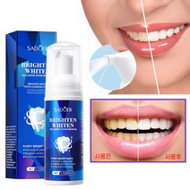 치아미백제 셀프 치아미백 치아 화이트닝 얼룩제거 구강 냄새제거, 5개, 60ml