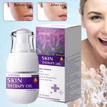 피부관리 30ml 스킨 테라피 오일 스트레치 마크 및 흉터 제거 손상된 피부 미백 보습 바디 케어