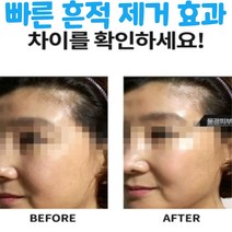 제이블릭 기미 반점 검버섯 주근깨 흔적 피부착색 제거 지우개 미스트 앰플 에센스 연고 크림 점제거 제거제 남성 여성 30대 40대 50대 60대 집중케어 크림, 효과빠른 미백 흔적 제거 1+1(할인)