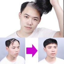 남자 원형 가발 정수리 똑딱이가발 M자커버 자연스러운 엠자이마 탈모가발 피스가발 남성가발 헤어스타일, 자연앞머리타입-대
