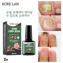 (국내산/당일발송) KORELAN 1 1 발톱무좀 발톱 발톱무좀약 발톱무좀약풀케어 발톱 진균 리페어 에센스, 20ml, 2개