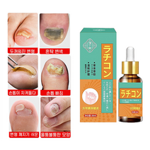 손발톱 무좀치료제 발톱연화 관리 조갑진균증약 곰팡이 살균에센스 케어제, 1개