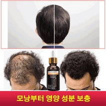 1+1 모발 성장 에센스 식물에 추출한 천연 성분 hair growth 모발 성장 에센스모낭 소통 탈모 방지 영양 보충 탈모 샴푸 영양제 30ml, 모발 성장 에센스(30ml)3+3