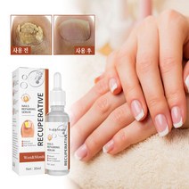 West&Month 발톱무좀치료 네일 트리트먼트 에센스 손발톱 강화리페어