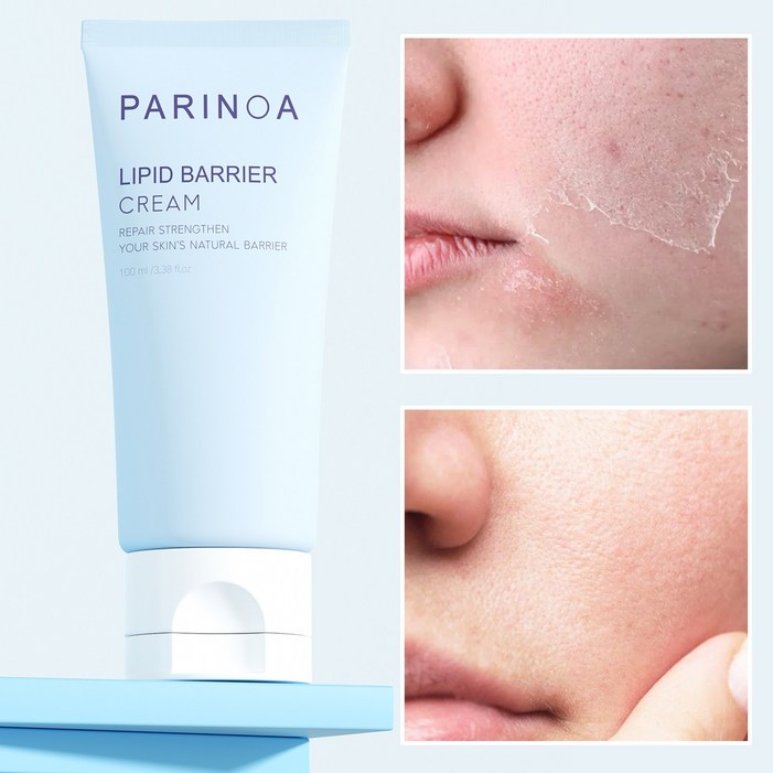 100시간 보습력 피부 장벽 크림 고보습가려움 아토베리어 365크림 세라마이드 센텔라 히알루론산 함유 잇칭크림 저자극 365플러스 수분크림 건조 가려움 진정 보습 수딩크림, 1개, 100ml