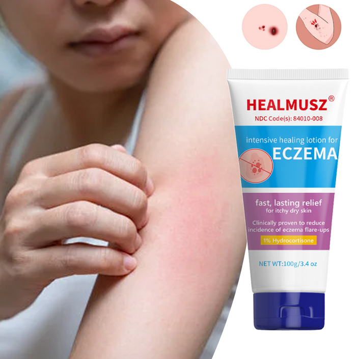HEALMUSZ 습진 크림 완화되다 피부 가려움증 습진 건선, 2개, 100ml HEALMUSZ 습진 크림 완화되다 피부 가려움증 습진 건선, 2개, 100ml