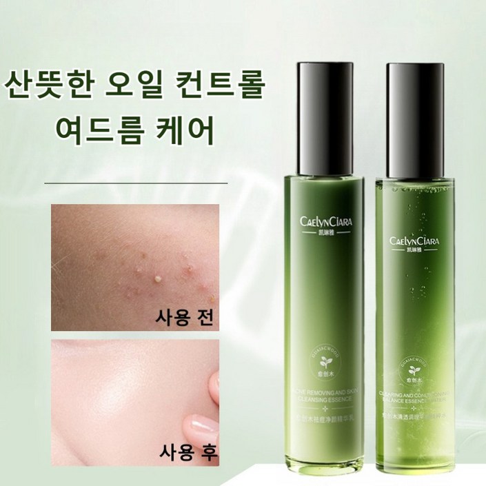 워터밸런스 스킨 로션 세트 여드름화장품 지성 피부 트러블 진정 스킨 화장품 여드름 진정 케어 토너115ml 로션 115ml 세트