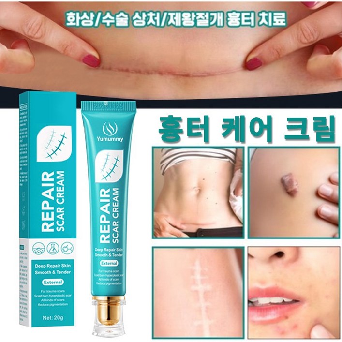 피부 관리 흉터 연고 화상 흉터 연고 화상연고, 1개, 20g