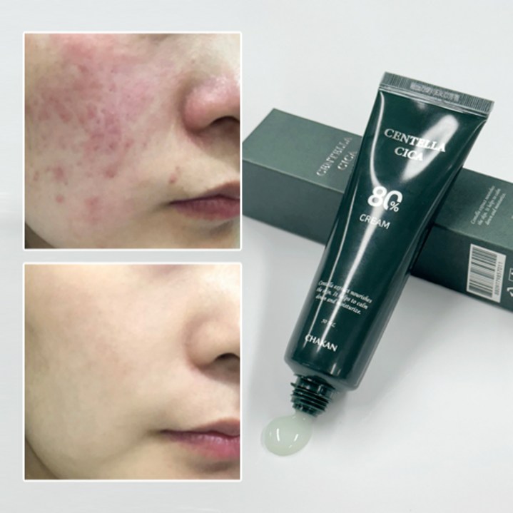 트러블 진정 모공 각질 피지케어 센텔라80% 시카크림, 50ml, 1개