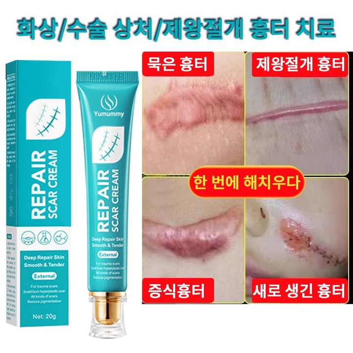 피부 관리 흉터 연고 화상 흉터 연고 화상연고 피부 관리 흉터 연고 화상 흉터 연고 화상연고