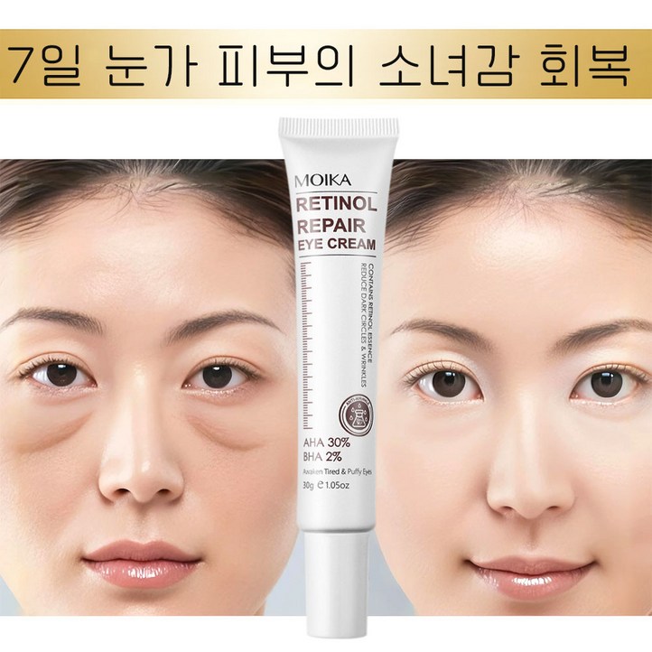 아이크림 눈 밑 지방 제거 크림 50대여성 아이크림추천 여성 아이크림 추천 60대 송채환 주름다나와 송채환 주름다나와세일 유세라블 리프팅 900샷 아이크림 녹는실 리프팅 아이크림