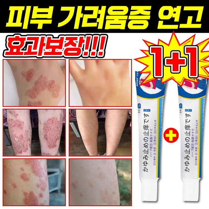일본 기술 1122 피부 가려움증 연고 건선 연고 치료제 습진 모낭염 연고 지루성 피부염 각종 피부 트러블 곰팡이균 볽은반점 완화 크림 일본 기술 1122 피부 가려움증 연고 건선 연고 치료제 습진 모낭염 연고 지루성 피부염 각종 피부 트러블 곰팡이균 볽은반점 완화 크림